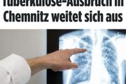 【傳染】開姆尼茨驚現肺結核患者，確診人數已達25人，有蔓延趨勢