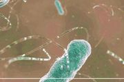 全球一半人感染的致癌細菌，正在突襲你家餐桌