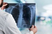 「新冠肺炎」對肺部還有損傷嗎？