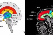 大腦核心區高畫質解剖圖譜，手繪圖+實體圖+影像圖，寶貴資料，建議收藏！