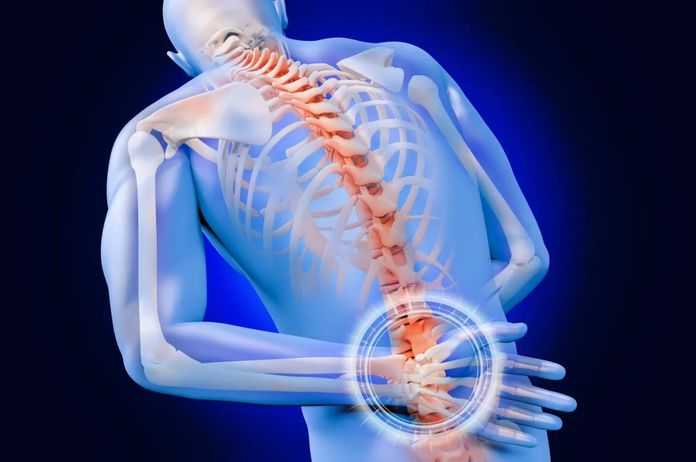 脊柱發炎就是強直性脊柱炎嗎？