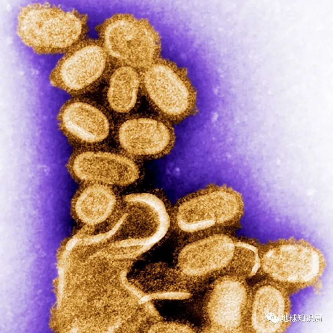 〓1918年的流感病毒（圖：CDC）