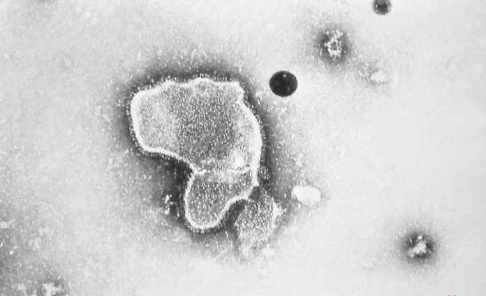 呼吸道合胞病毒（RSV）的電子顯微照片